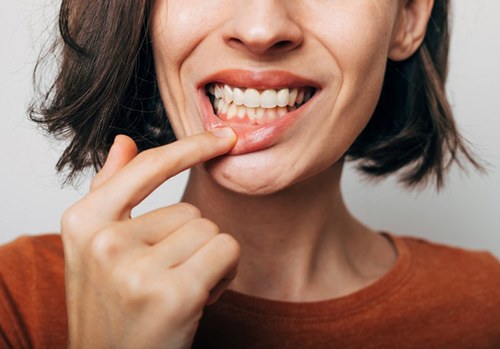 Lady shows teeth with indistinguishable dental crown