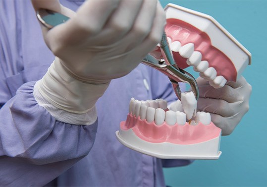 The process of extracting a tooth is streamlined and efficient in Huntington Beach, CA